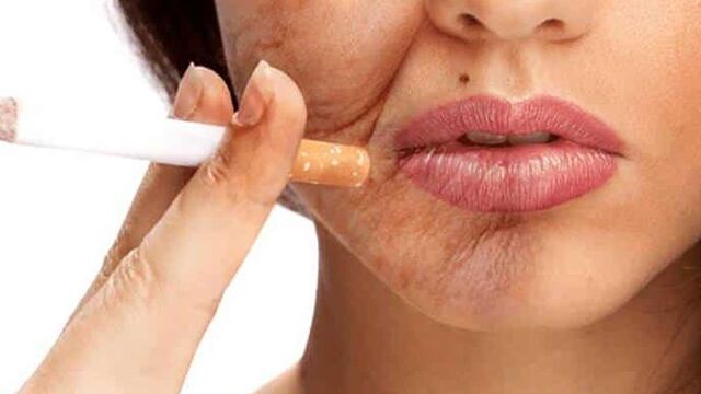 Dampak Rokok pada Kulit